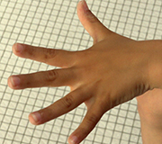 18 Fingermuskeln
